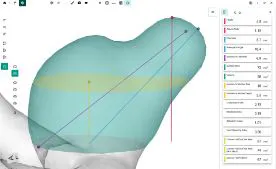 FlowLens screenshot 5