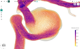 FlowLens screenshot 7