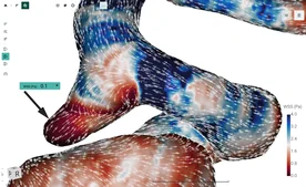 FlowLens screenshot 9