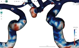 FlowLens screenshot 13