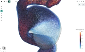 FlowLens screenshot 16